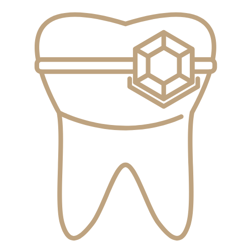 Minimal Tooth Alteration