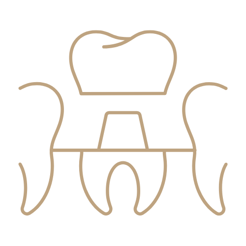 Porcelain-fused-to-metal Crowns