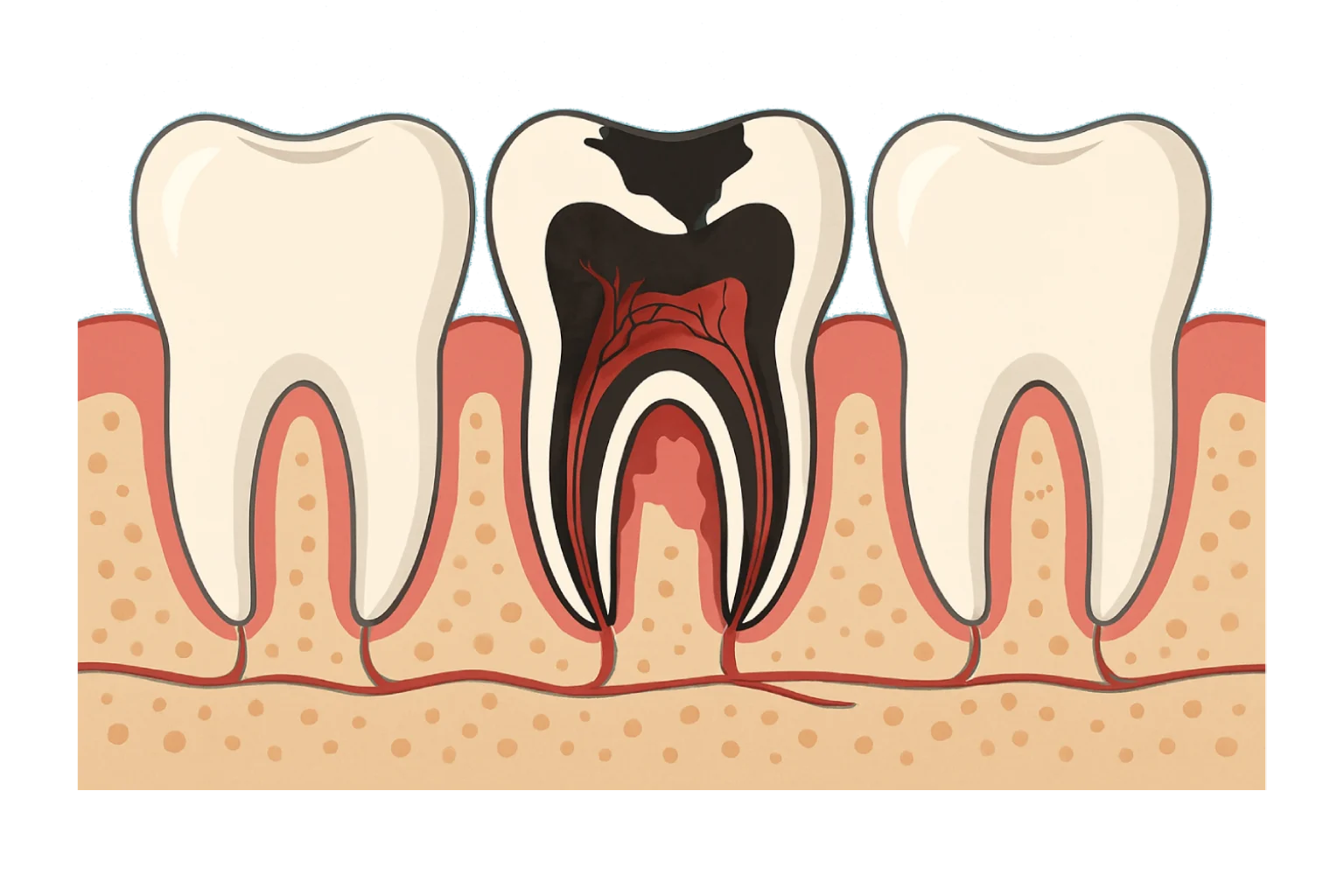 single tooth Infection