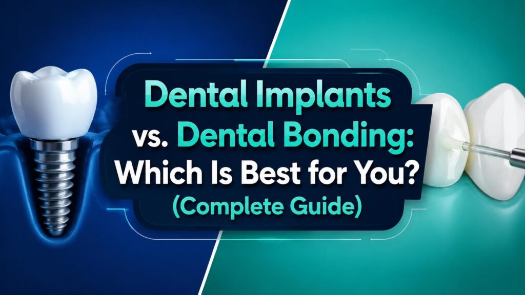 Dental Implants vs. Dental Bonding: Which Is Best for You? (Complete Guide)